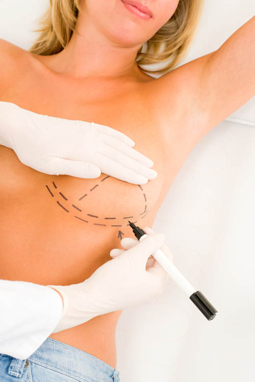 Breast Lift Surgery / Breast Firming / Mastopexy